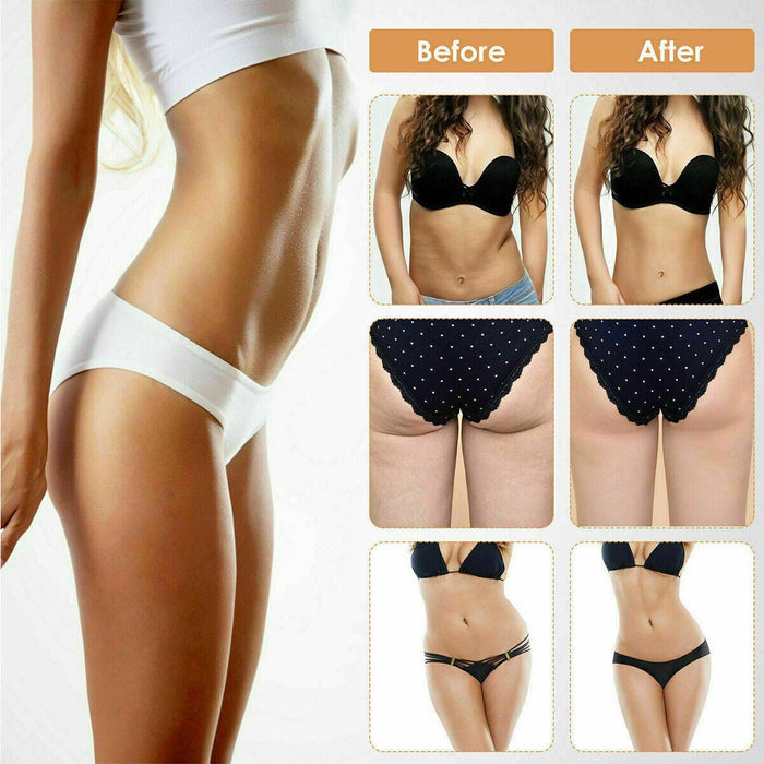 Professional Ultrasonic Cavitation RF Laser Lipo Machine -  Fat Reduction & Weight Loss (SAK95112) - Sweatfully